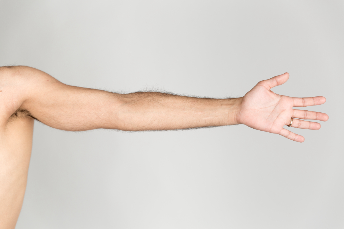 Arm Wiki