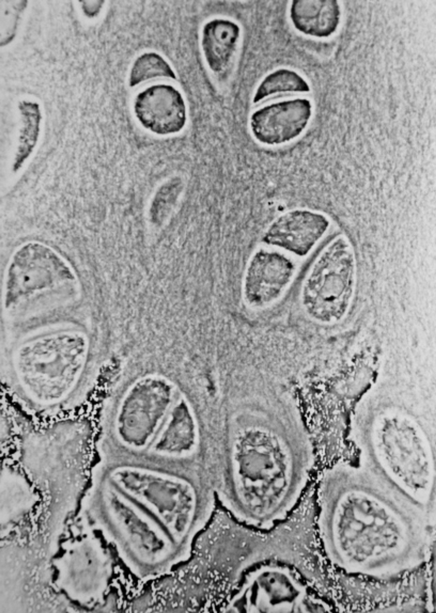 <a href="/content/Light_micrograph" style="color:blue">Light micrograph</a> of <a href="/content/Hyaline_cartilage" style="color:blue">hyaline cartilage</a> showing <a href="/content/Chondrocyte" style="color:blue">chondrocytes</a> and <a href="/content/Organelle" style="color:blue">organelles</a>, <a href="/content/Lacuna_(histology)" style="color:blue">lacunae</a> and <a href="/content/Extracellular_matrix" style="color:blue">matrix</a>