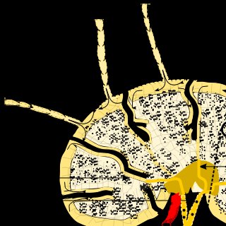 Trabecular sinuses Wiki