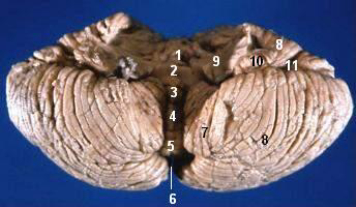 Human cerebellum anterior view description (Vallecula cerebelli is #6)