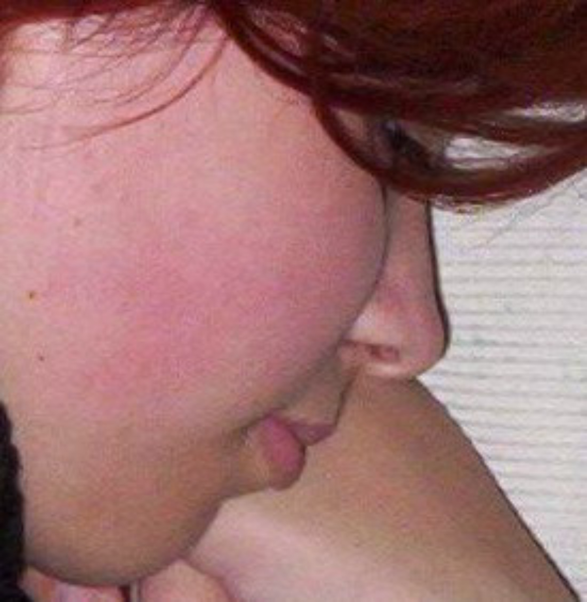 Girl with puffy cheeks